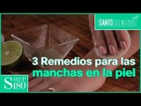 Los mejores remedios para eliminar las manchas en la piel