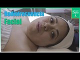 ¿Cómo funciona la Radiofrecuencia facial? | Salud180