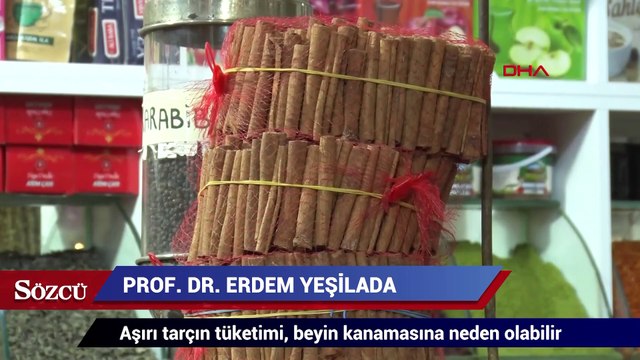 Aşırı tarçın tüketimi, beyin kanamasına neden olabilir