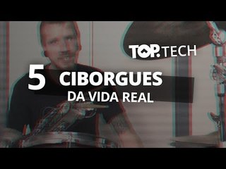 5 ciborgues da vida real