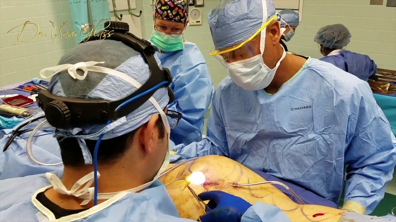 Buttock implant revision surgery