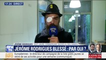 Le gilet jaune Jérôme Rodrigues affirme que sa blessure à l’œil a été causée par 