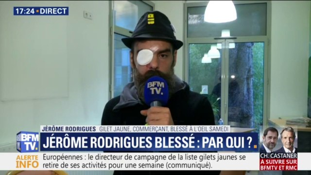 Le gilet jaune Jérôme Rodrigues affirme que sa blessure à l’œil a été causée par un impact et non pas des éclats de grenade
