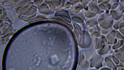 Santé - Ad Vitam Aeternam