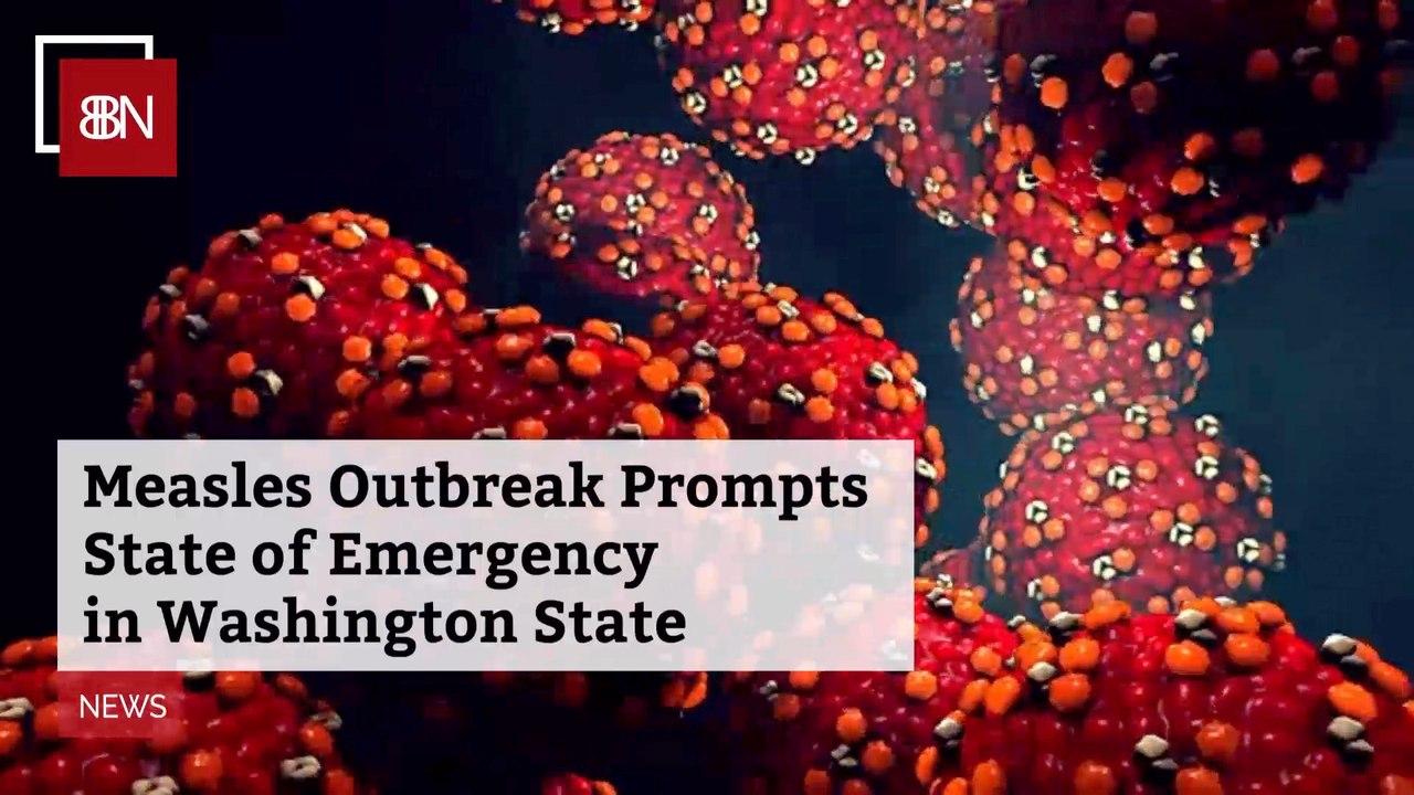 Serious Measles Outbreak Causes An Emergency