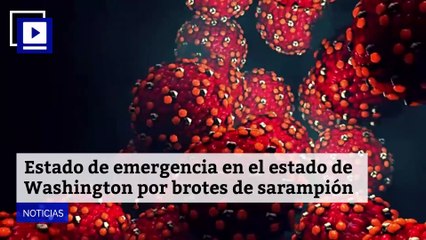 Descargar video: Estado de emergencia en el estado de Washington por brotes de sarampión