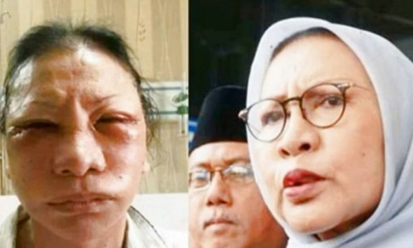 Berkas Perkara Ratna Sarumpaet Dinyatakan P21