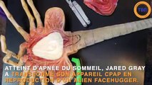 Atteint d’apnée du sommeil, il transforme son masque respiratoire en Alien Facehugger !