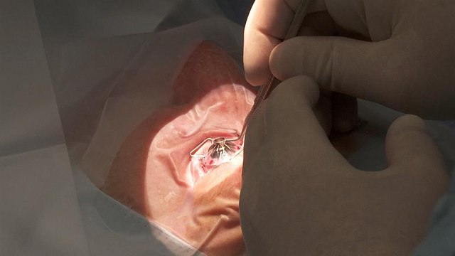 Video: Bilim insanları biyolojik robotlar yardımıyla kendi kendine şekil alan yapay kornea üretti