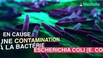 Alerte : des moules contaminées à l'E.Coli