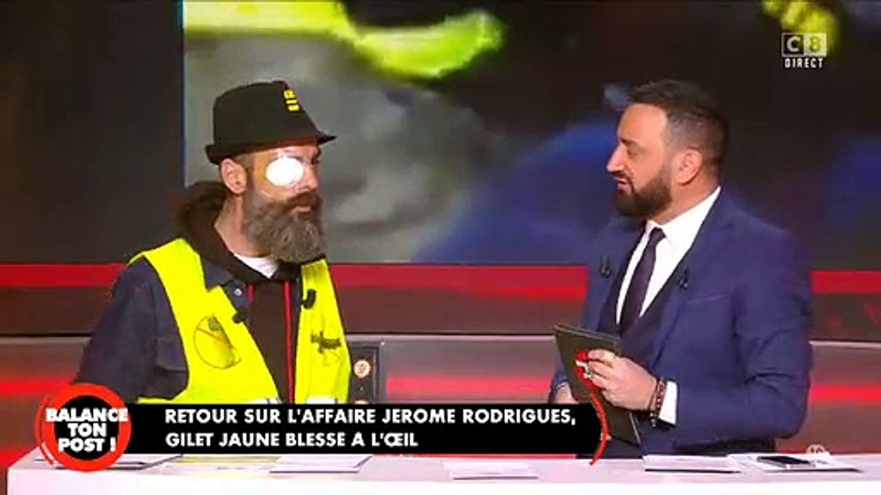 Gilets Jaunes : Jérôme Rodrigues raconte son opération: "Même si je retrouve la vue, si mon oeil me fait mal, on sera obligé de me l'enlever "