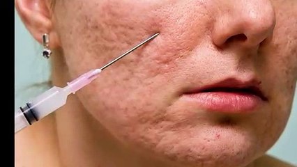 Results Laser Clinic