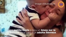 Une petite fille atteinte d'herpès mortel à cause d'un bisou sur la bouche