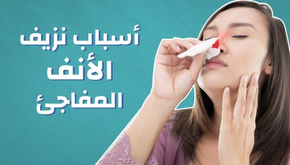 أسباب نزيف الأنف المفاجئ