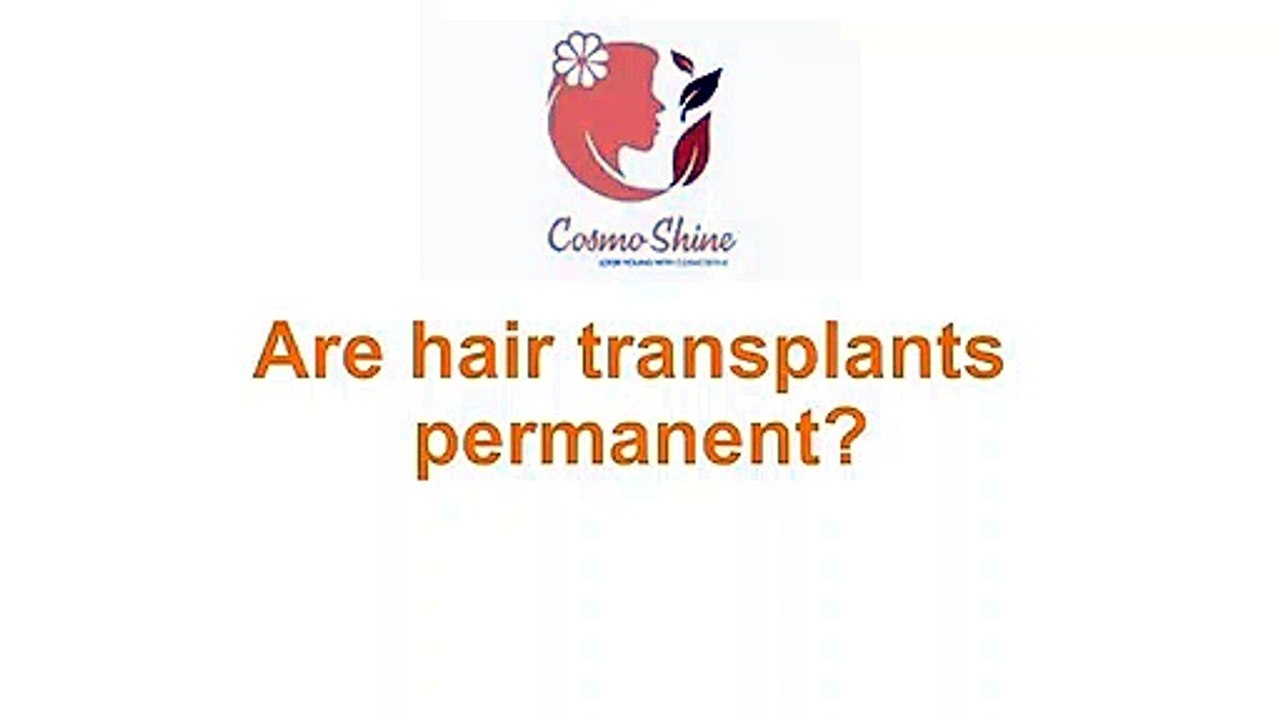 Are hair transplants permanent?