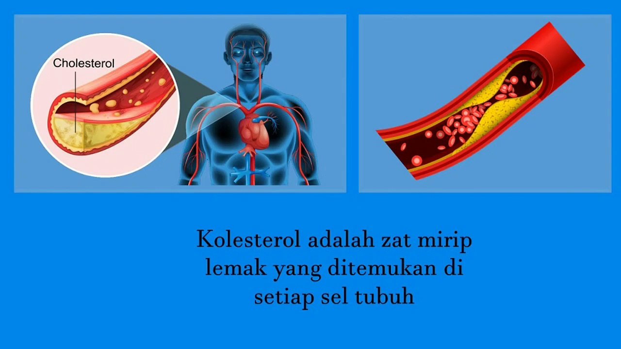 Cara Menurunkan Kolesterol Tinggi Secara Alami