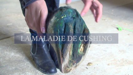 Le syndrome de Cushing