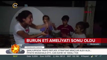 Burun eti ameliyatı sonu oldu