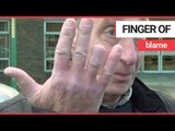 A postman had his finger bitten off by a dog as he pushed a letter through their box | SWNS TV