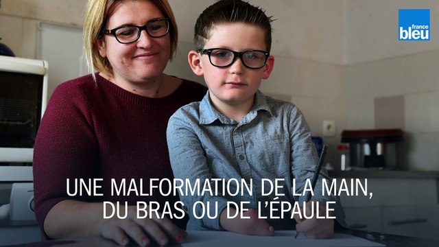 Tout comprendre sur l'affaire des bébés nés sans bras