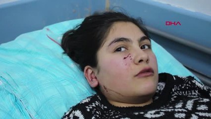 Adıyaman'da Köpeğin Saldırdığı Öğrenci Yaralandı