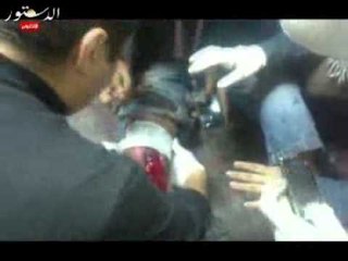 شاهد.. أخطر اصابة فى محمد محمود