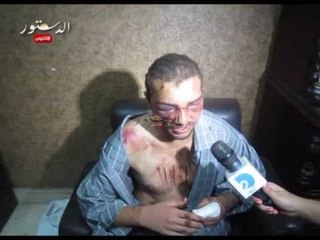 سايس رابعة يروي للدستور اعتداء الإخوان عليه وقطع أحد أصابعه