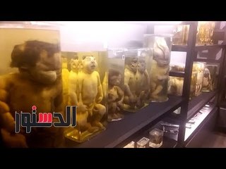 الدستور - لأول مرة.. عرض 1300 حالة مرضية نادرة بالهواتف الذكية