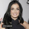 Dayanara Torres diagnosed with skin cancer