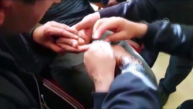 Parmağına sıkışan yüzüğü itfaiye ekipleri çıkardı - ADIYAMAN