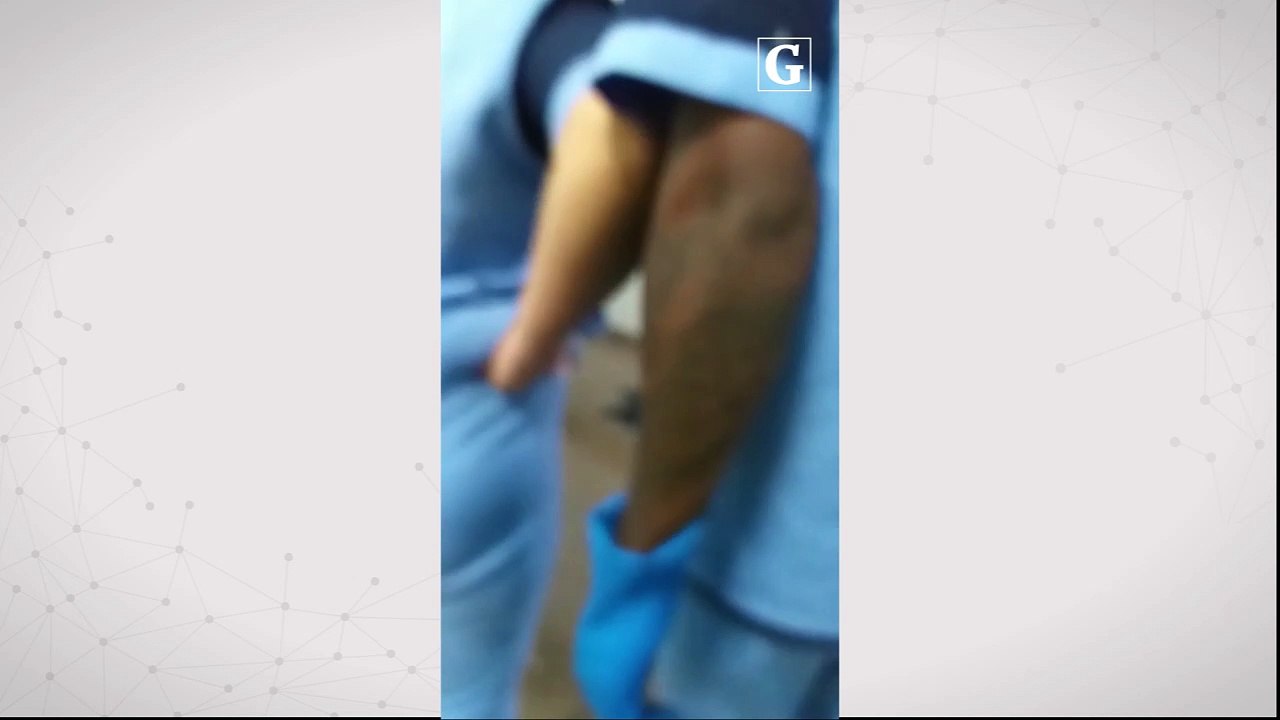 Parte do teto cai na UTI do Hospital Antônio Bezerra de Faria, em Vila Velha