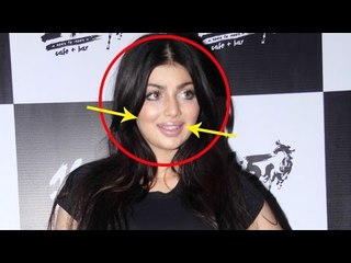 Ayesha Takia is UNRECOGNISABLE after horrible PLASTIC SURGERY!