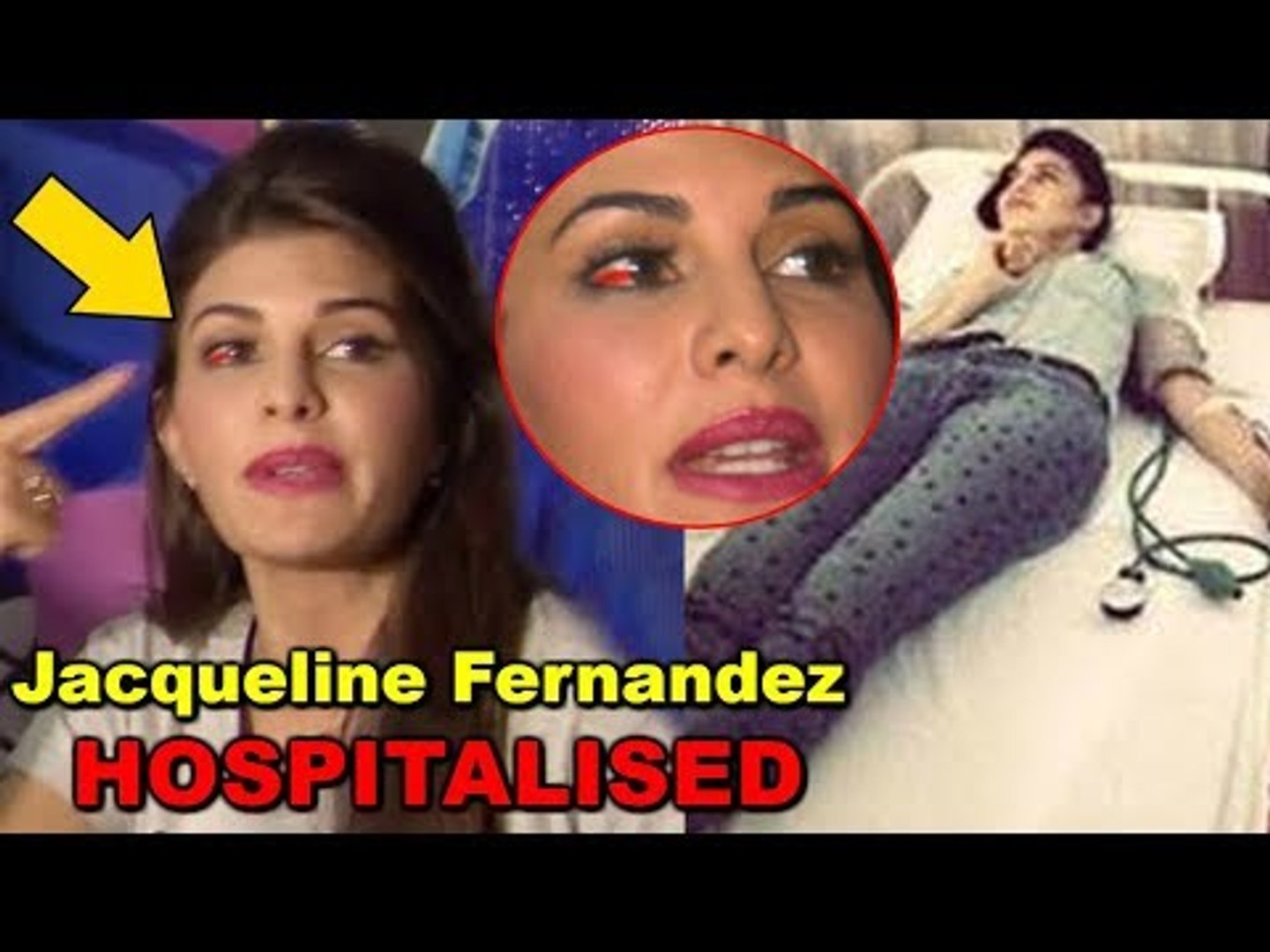 Omg Jacqueline Fernandez Hospitalised Suffers Eye Injury While