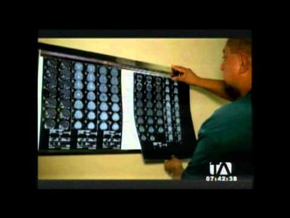 Especialistas realizarán cirugías gratuitas en el Hospital Padre Carolo