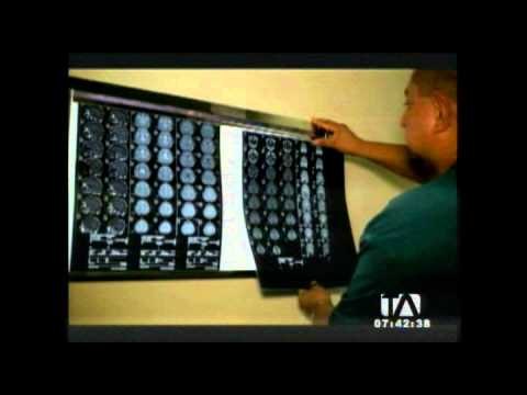 Especialistas realizarán cirugías gratuitas en el Hospital Padre Carolo