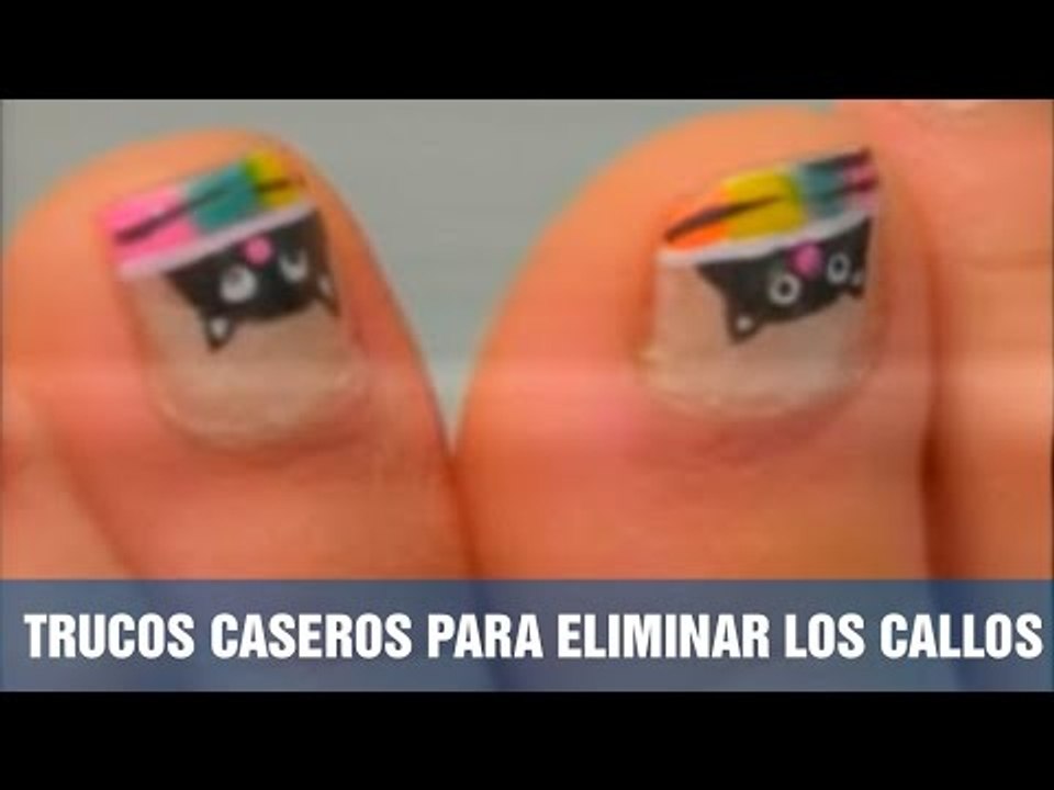Trucos caseros para eliminar los callos de los pies