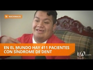 Daniel Carrera es el único paciente con Síndrome de Dent en Ecuador