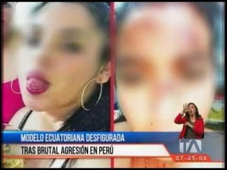 Modelo ecuatoriana desfigurada tras brutal agresión en Perú