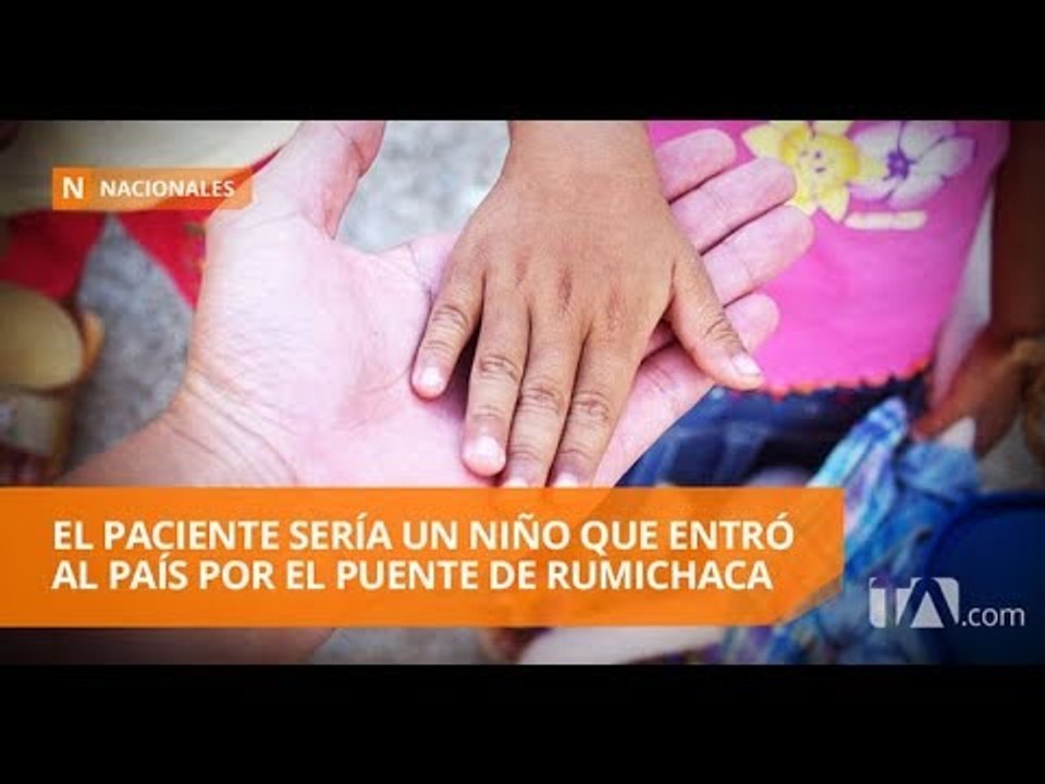 Salud confirma la detección de un caso importado de sarampión - Teleamazonas