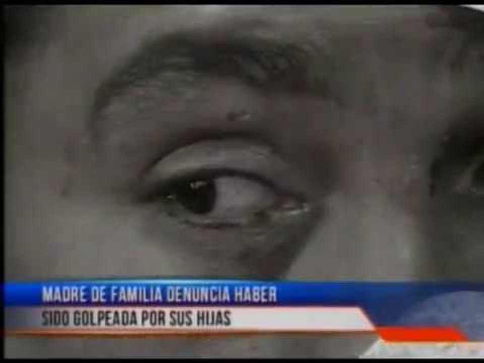 Madre de familia denuncia haber sido golpeada por sus hijas