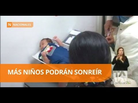 Operación Sonrisa: Intervención gratuita para niños - Teleamazonas