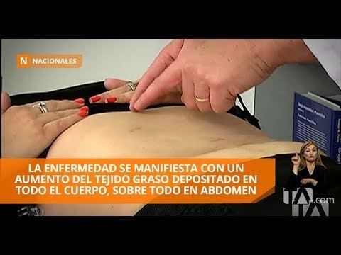 Llegó a pesar 223 libras y presentó obesidad mórbida - Teleamazonas