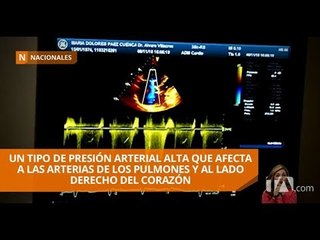 Download Video: Noviembre es el mes de los pacientes con hipertensión pulmonar - Teleamazonas