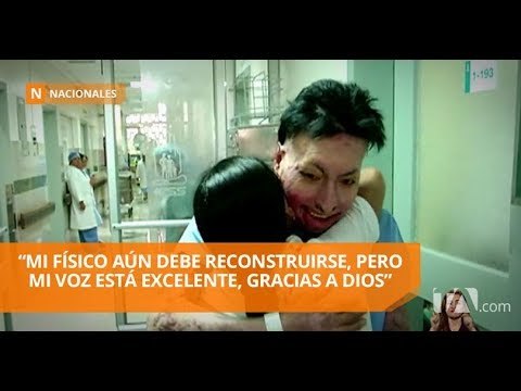 Joven músico que sufrió quemaduras en el 85% de su cuerpo se recupera - Teleamazonas