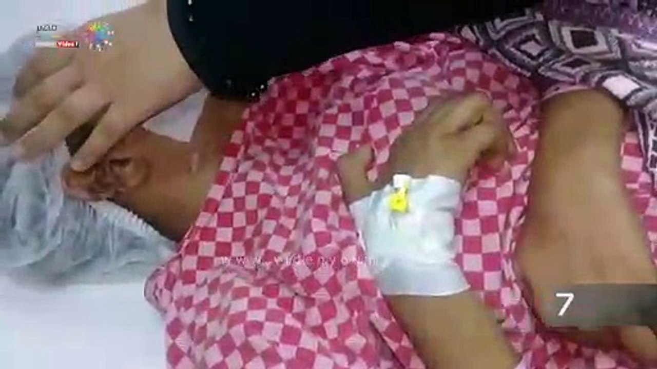 "فرح" طفلة بين الحياة والموت.. تحولت حياتها لجحيم بسبب فتحة أسانسير