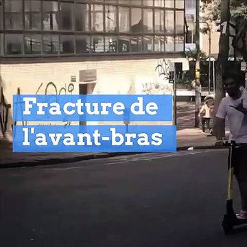 Les trottinettes électriques ont fait des centaines de blessés aux Etats-Unis