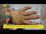 Lo acusan de maquillar los moretones de su hija