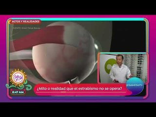 Mitos y Realidades sobre los ojos: miopía, el extravismo y más | Sale el Sol