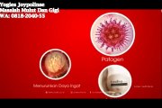 WA: 0818-2040-55 | 	 Obat Kumur Radang	, Yogies Joypolinse