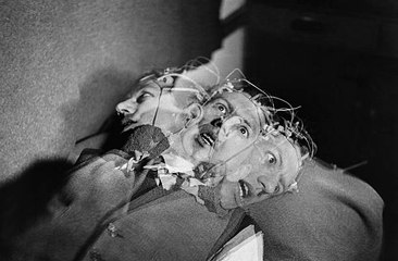 Epilepsie : quelle est cette maladie qui touche 50 millions de personnes  ?